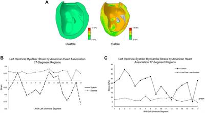 Left Ventricle Biomechanics of Low-Flow, Low-Gradient Aortic Stenosis: A Patient-Specific Computational Model